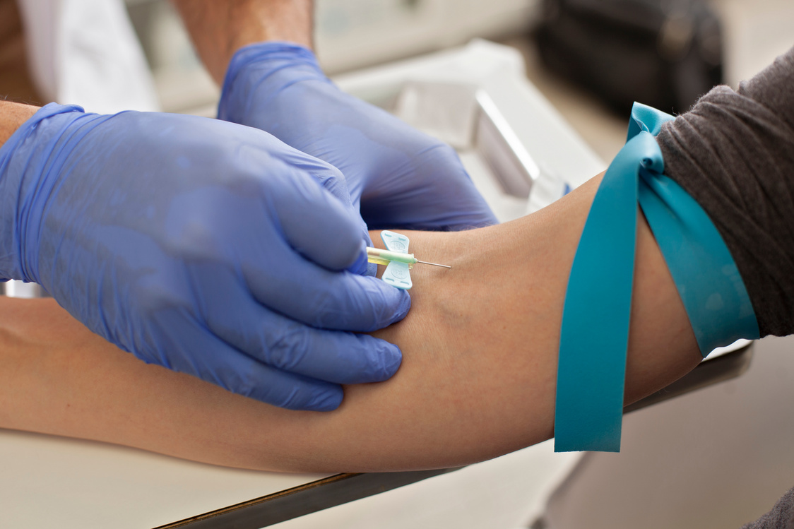 Blood Test